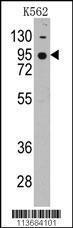 Anti-CDH7 Rabbit Polyclonal Antibody (AP (Alkaline Phosphatase))