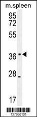 Anti-KLHDC1 Rabbit Polyclonal Antibody (HRP (Horseradish Peroxidase))