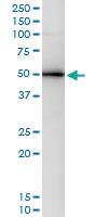 Anti-GART Polyclonal Antibody Pair