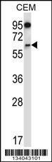 Anti-NOX4 Rabbit Polyclonal Antibody (AP (Alkaline Phosphatase))