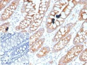 Immunohistochemical analysis of formalin-fixed, paraffin-embedded human colon tissue using Anti-PDGFB Antibody [PDGFB/3071] Inset: PBS instead of the primary antibody Secondary antibody negative control