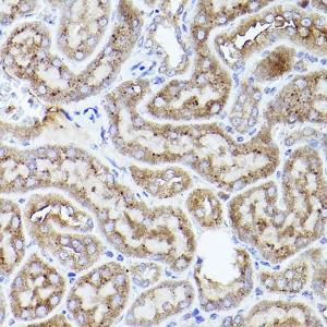 Immunohistochemistry analysis of paraffin-embedded mouse kidney using Anti-Thrombospondin 1 Antibody (A11512) at a dilution of 1:50 (40x lens). Perform high pressure antigen retrieval with 10 mM citrate buffer pH 6.0 before commencing with IHC staining protocol.