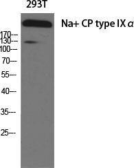 Anti-pan Sodium Channel Rabbit Polyclonal Antibody