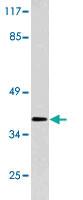 Anti-HOXB2 Rabbit Polyclonal Antibody