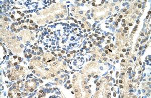 Anti-DAZAP1 Rabbit Polyclonal Antibody