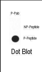 Anti-CDX2 Rabbit Polyclonal Antibody (Biotin)