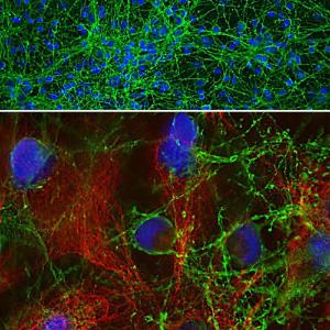 Immunofluorescent analysis of cortical neuron-glial cell culture from E20 rat stained with Anti-GAP43 Antibody (1:2,000 / green) and Anti-Vimentin Antibody (A85423 / 1:2,000 / red). The blue is DAPI staining of nuclear DNA.