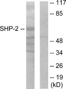 Western blot analysis of lysates from A431 cells using Anti-SHP-2 Antibody. The right hand lane represents a negative control, where the antibody is blocked by the immunising peptide