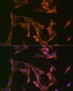 Immunofluorescence analysis of NIH-3T3 cells using Anti-Arp3 Antibody [ARC1067] (A306350) at a dilution of 1:100 (40x lens). DAPI was used to stain the cell nuclei (blue).