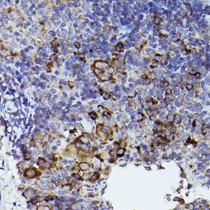 Immunohistochemistry analysis of paraffin-embedded mouse spleen using Anti-Thrombospondin 1 Antibody (A11512) at a dilution of 1:50 (40x lens). Perform high pressure antigen retrieval with 10 mM citrate buffer pH 6.0 before commencing with IHC staining protocol.