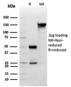 SDS-PAGE analysis of Anti-PDGFB Antibody [PDGFB/3071] under non-reduced and reduced conditions; showing intact IgG and intact heavy and light chains, respectively SDS-PAGE analysis confirms the integrity and purity of the antibody