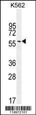 Anti-EIF2B4 Rabbit Polyclonal Antibody (PE (Phycoerythrin))