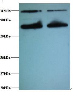 Anti-CALR3 Rabbit Polyclonal Antibody