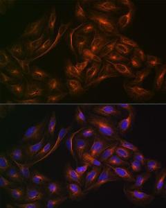 Immunofluorescence analysis of U-2 OS cells using Anti-Arp3 Antibody [ARC1067] (A306350) at a dilution of 1:100 (40x lens). DAPI was used to stain the cell nuclei (blue).