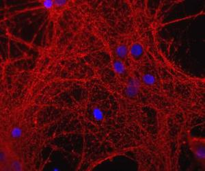 Mixed neuron-glial cultures stained with Anti-GAP43 Antibody (red). Blue is DNA staining.