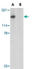 Anti-SLITRK5 Rabbit Polyclonal Antibody