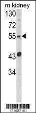 Anti-SIL1 Rabbit Polyclonal Antibody