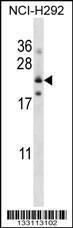 Anti-FOLR3 Rabbit Polyclonal Antibody (AP (Alkaline Phosphatase))