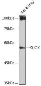 Western blot analysis of extracts of Rat kidney, using Anti-Sulfite oxidase Antibody [ARC2535] (A306351) at 1:1,000 dilution The secondary antibody was Goat Anti-Rabbit IgG H&L Antibody (HRP) at 1:10,000 dilution Lysates/proteins were present at 25 µg per lane