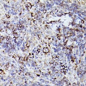 Immunohistochemistry analysis of paraffin-embedded rat spleen using Anti-Thrombospondin 1 Antibody (A11512) at a dilution of 1:50 (40x lens). Perform high pressure antigen retrieval with 10 mM citrate buffer pH 6.0 before commencing with IHC staining protocol.