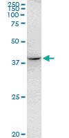 Anti-RHOXF2 Mouse Monoclonal Antibody [clone: 3C4]