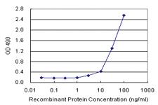 Anti-NUMB Antibody Pair