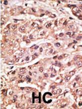 Anti-SUMO4, mutant Rabbit Polyclonal Antibody (HRP (Horseradish Peroxidase))