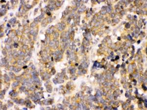 Anti-PDPK1 Rabbit Polyclonal Antibody