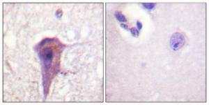 Immunohistochemical analysis of paraffin-embedded human brain using Anti-SHP-2 Antibody 1:100 (4°C overnight). The right hand panel represents a negative control, where the antibody was pre-incubated with the immunising peptide