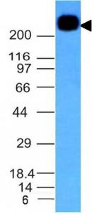 Western blot analysis of Daudi cell lysate using Anti-CD45RB Antibody [PTPRC/1132]