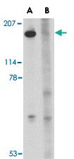 Anti-SLITRK5 Rabbit Polyclonal Antibody