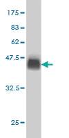 Anti-USP9X Mouse Monoclonal Antibody [clone: 1C4]