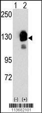 Anti-CDH8 Rabbit polyclonal antibody unconjugated