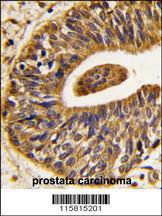 Anti-ERBB2 Rabbit Polyclonal Antibody (FITC (Fluorescein))