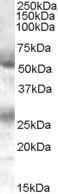 Anti-FLVCR1 Antibody (A84051) (0.1 µg/ml) staining of Human Bone Marrow lysate (35 µg protein in RIPA buffer). Primary incubation was 1 hour. Detected by chemilu minescence