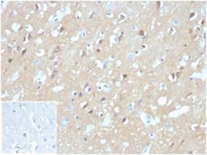 Immunohistochemical analysis of formalin-fixed, paraffin-embedded human brain tissue using Anti-Aquaporin 4 Antibody [AQP4/3324]. Inset: PBS instead of the primary Antibody. Secondary Antibody negative control