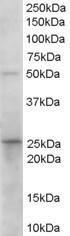 Anti-HPGD Antibody (A84052) (0.1 µg/ml) staining of Human Duodenum lysate (35 µg protein in RIPA buffer). Primary incubation was 1 hour. Detected by chemiluminescence