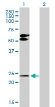 Anti-TGIF2 Rabbit Polyclonal Antibody