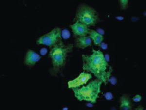 Anti-MGLL Mouse Monoclonal Antibody [clone: OTI1B1]