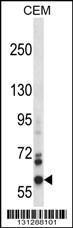 Anti-NOX5 Rabbit Polyclonal Antibody (Biotin)