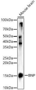 Anti-BNP Antibody (A11515)