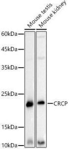 Western blot analysis of extracts of various cell lines, using Anti-CRCP Antibody [ARC3031] (A309337) at 1:500 dilution. The secondary Antibody was Goat Anti-Rabbit IgG H&L Antibody (HRP) at 1:10000 dilution. Lysates/proteins were present at 25 µg per lane