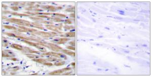 Antibody anti-MAP3K4 100 µg