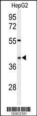 Anti-NXN Rabbit Polyclonal Antibody