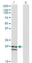 Anti-IFNA2 Mouse Monoclonal Antibody [clone: 1D1]