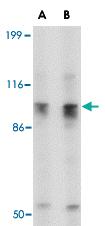 Anti-SLITRK6 Rabbit Polyclonal Antibody