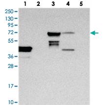 Anti-NGLY1 Rabbit Polyclonal Antibody