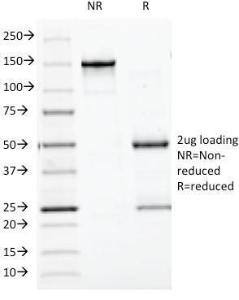 SDS-PAGE analysis of Anti-Chromogranin A Antibody [CGA/413] under non-reduced and reduced conditions; showing intact IgG and intact heavy and light chains, respectively. SDS-PAGE analysis confirms the integrity and purity of the antibody.