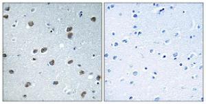 Immunohistochemical analysis of paraffin-embedded human brain tissue using Anti-KLHL29 Antibody The right hand panel represents a negative control, where the antibody was pre-incubated with the immunising peptide