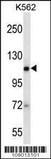 Anti-AGO2 Rabbit Polyclonal Antibody (FITC (Fluorescein Isothiocyanate))